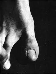 Slađana Bukovac: Doktor Jusuf ili zašto ono što je moguće u Obrovcu nije moguće nigdje&nbsp;drugdje