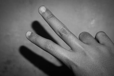 Ana Nikvul: Dva prsta za&nbsp;za